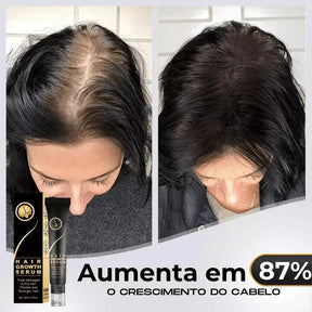 Repair Hair® | Crescimento Capilar e Combate à Queda de Cabelo